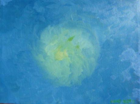 MRT / Kernspin (02/2010) - Reinhard KIKI - Array auf Array - Array - MRT / Kernspin (02/2010) - Reinhard KIKI - Array auf Array - Array -